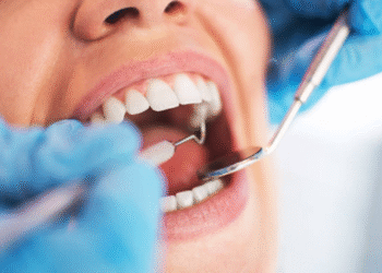 oral considerattion tips