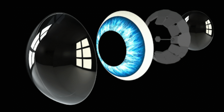 what are contact lenses